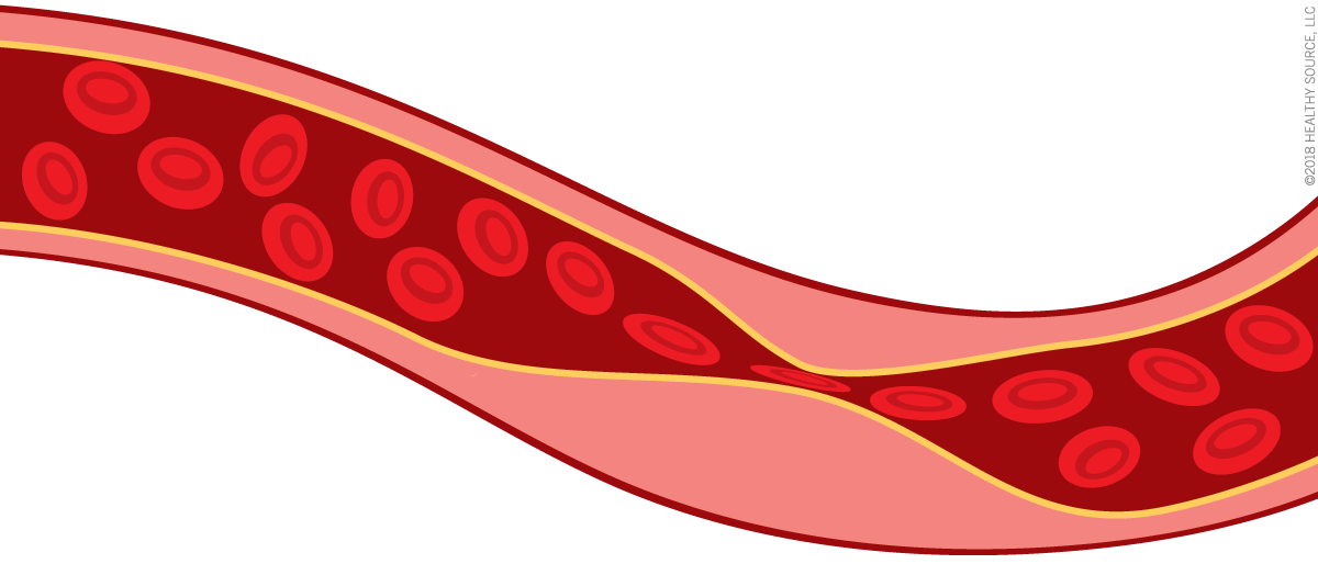 Flavay improves red blood cell membranes so they remain flexible.