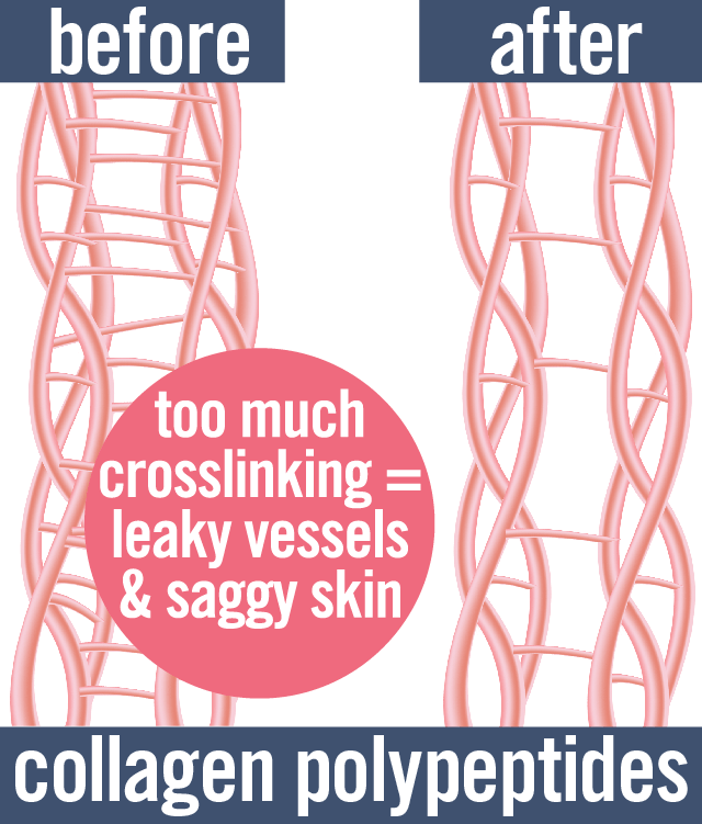 too much crosslinking in collagen polypeptides causes leaky vessels and saggy skin