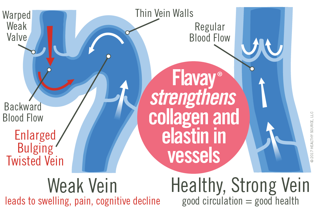 Weak veins are enlarged, bulging and twisted with warped weak valves, thin vein walls, irregular blood flow, and result in edema, swollen legs, ankles and feet. Healthy veins provide good circulation to heart, regular blood flow with normal vein walls and valves.